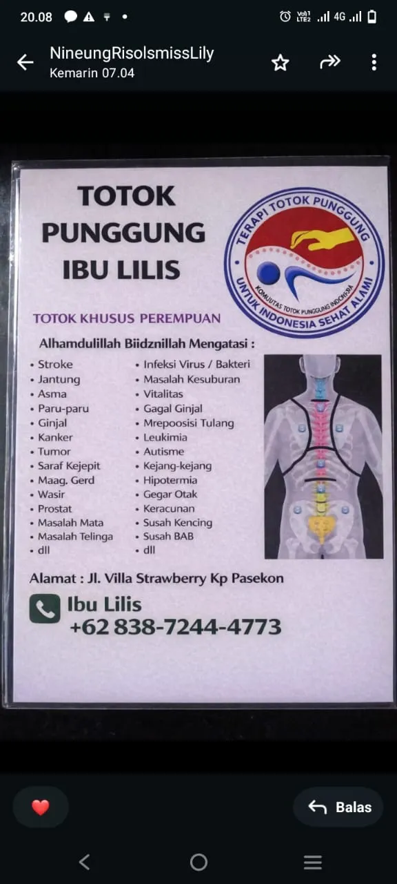 Bekam